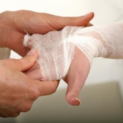 Pakai Obat Merah Buat Luka, Bahaya Buat Otak!