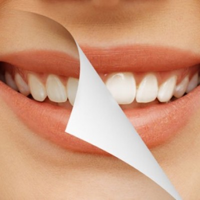 Pengen Gigi Bagus? Nggak Usah Sikat Gigi!